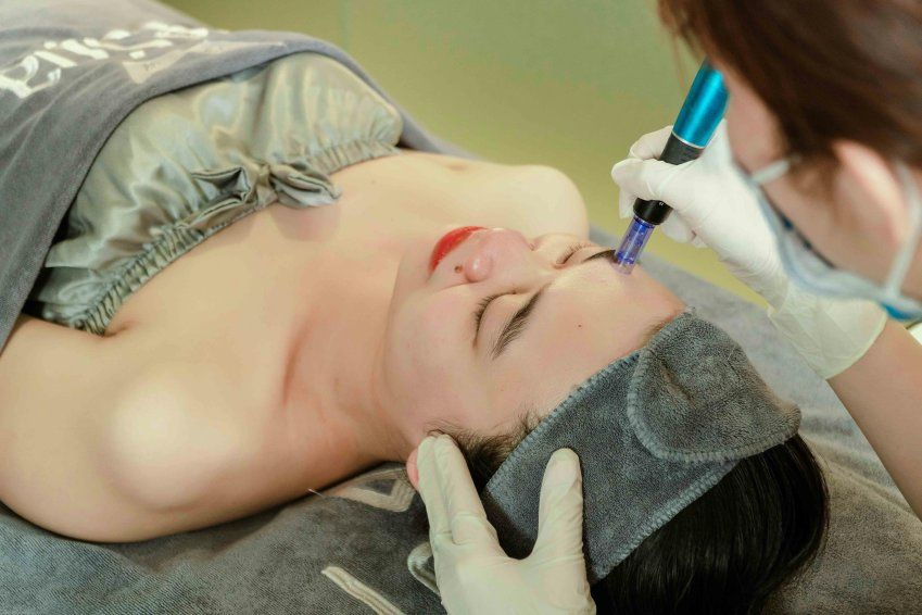 Microneedling en el Retiro
