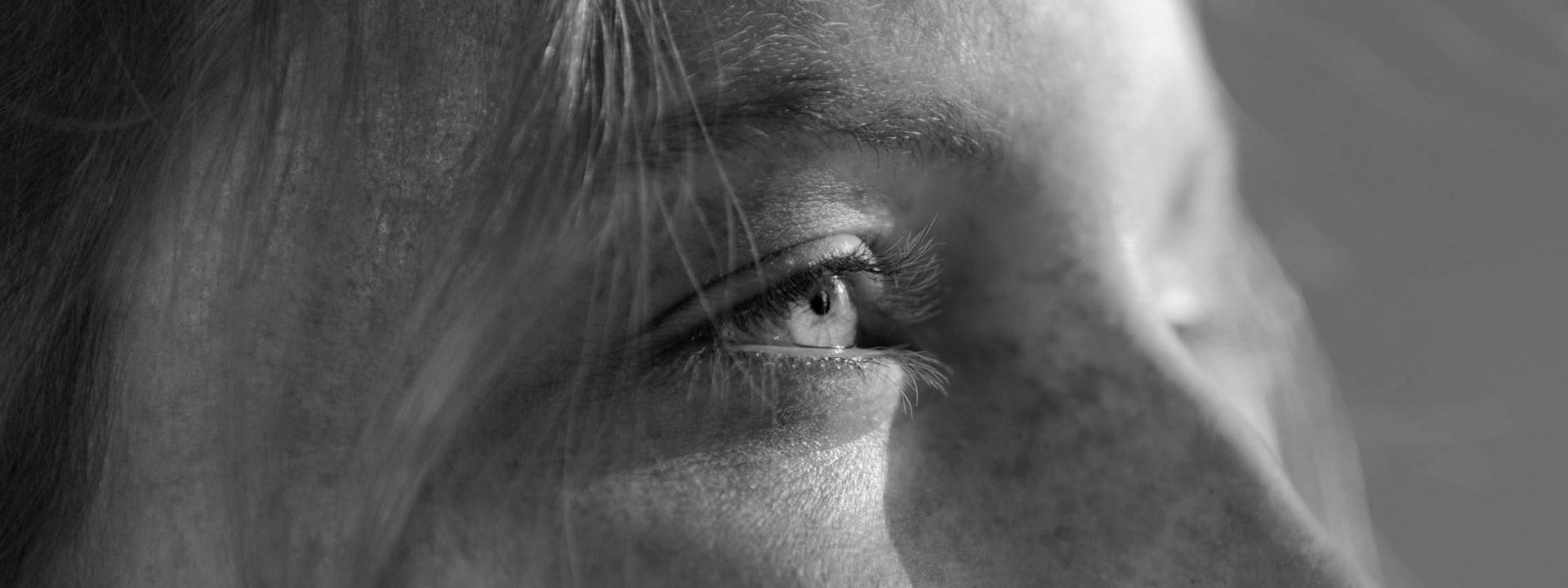 Higiene facial en Madrid