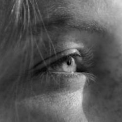 Higiene facial en Madrid